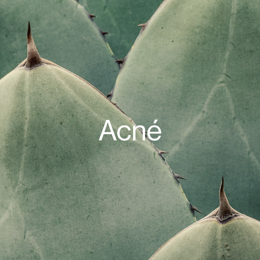 Acné y brotes